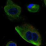 DCDC2 Polyclonal Antibody