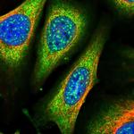 ARHGAP18 Polyclonal Antibody