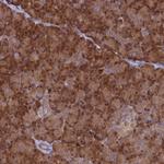 ARHGAP18 Antibody in Immunohistochemistry (Paraffin) (IHC (P))