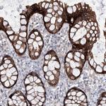 Lano Antibody in Immunohistochemistry (IHC)