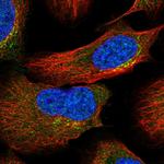 ASCC3 Polyclonal Antibody