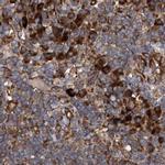 ASCC3 Antibody in Immunohistochemistry (IHC)