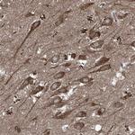 FOXRED2 Polyclonal Antibody