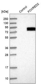 FOXRED2 Antibody in Western Blot (WB)