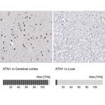Atrophin 1 Antibody in Immunohistochemistry (IHC)