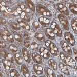 FASTK Antibody in Immunohistochemistry (Paraffin) (IHC (P))