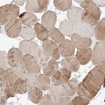 FASTK Antibody in Immunohistochemistry (Paraffin) (IHC (P))