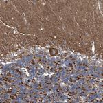 PIGH Antibody in Immunohistochemistry (Paraffin) (IHC (P))