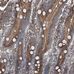 PIGH Antibody in Immunohistochemistry (Paraffin) (IHC (P))