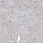 PIGH Antibody in Immunohistochemistry (Paraffin) (IHC (P))