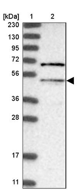 MCD Antibody in Western Blot (WB)