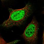 POGK Polyclonal Antibody