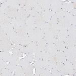 POGK Antibody in Immunohistochemistry (Paraffin) (IHC (P))