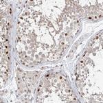 POGK Antibody in Immunohistochemistry (Paraffin) (IHC (P))