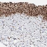 POGK Antibody in Immunohistochemistry (Paraffin) (IHC (P))