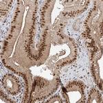 POGK Antibody in Immunohistochemistry (IHC)