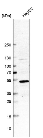 PAH Antibody in Western Blot (WB)