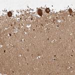 GHDC Antibody in Immunohistochemistry (Paraffin) (IHC (P))