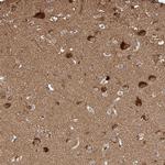 GHDC Antibody in Immunohistochemistry (Paraffin) (IHC (P))