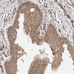 GHDC Polyclonal Antibody