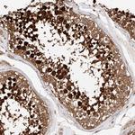 GHDC Antibody in Immunohistochemistry (Paraffin) (IHC (P))