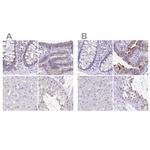 ANKRD45 Antibody in Immunohistochemistry (IHC)
