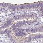 ANKRD45 Antibody in Immunohistochemistry (IHC)