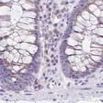 ANKRD45 Antibody in Immunohistochemistry (IHC)