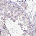 ANKRD45 Antibody in Immunohistochemistry (IHC)