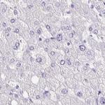 ANKRD45 Antibody in Immunohistochemistry (IHC)