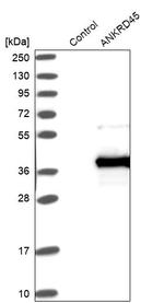 ANKRD45 Antibody in Western Blot (WB)