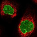 AHCTF1 Polyclonal Antibody