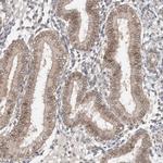 AHCTF1 Antibody in Immunohistochemistry (Paraffin) (IHC (P))