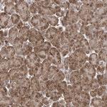 AHCTF1 Antibody in Immunohistochemistry (Paraffin) (IHC (P))