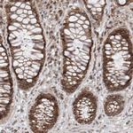 AHCTF1 Antibody in Immunohistochemistry (Paraffin) (IHC (P))