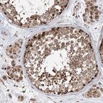 AHCTF1 Antibody in Immunohistochemistry (Paraffin) (IHC (P))
