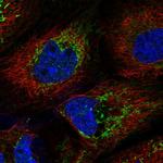 PPA2 Polyclonal Antibody