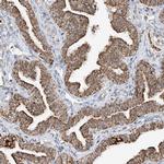 PPA2 Antibody in Immunohistochemistry (Paraffin) (IHC (P))