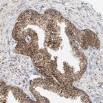 PPA2 Antibody in Immunohistochemistry (Paraffin) (IHC (P))
