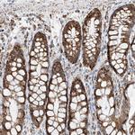 PPA2 Antibody in Immunohistochemistry (Paraffin) (IHC (P))