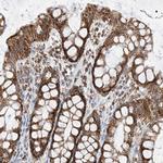 PPA2 Antibody in Immunohistochemistry (IHC)