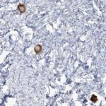 TMEM209 Antibody in Immunohistochemistry (Paraffin) (IHC (P))