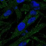 EPG5 Polyclonal Antibody