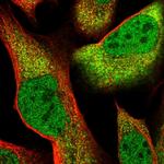 CLNS1A Polyclonal Antibody