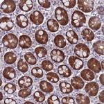 CLNS1A Antibody in Immunohistochemistry (Paraffin) (IHC (P))