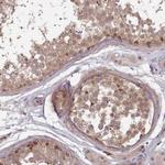 CLNS1A Polyclonal Antibody