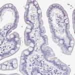 PERM1 Polyclonal Antibody