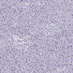 PERM1 Antibody in Immunohistochemistry (IHC)
