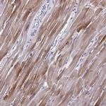 PERM1 Antibody in Immunohistochemistry (IHC)