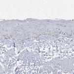 PERM1 Polyclonal Antibody